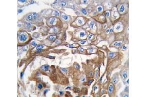 Immunohistochemistry (IHC) image for anti-GTPase NRas (NRAS) (AA 147-179) antibody (ABIN3031131)