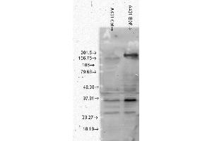 Western Blot analysis of Human A431 cell lysates showing detection of Phosphotyrosine protein using Mouse Anti-Phosphotyrosine Monoclonal Antibody, Clone G104 . (Phosphotyrosine antibody  (PE))