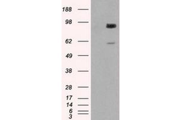 GBE1 antibody