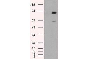 Western Blotting (WB) image for anti-Glucan (1,4-alpha-), Branching Enzyme 1 (GBE1) antibody (ABIN1498395) (GBE1 antibody)