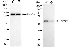 Western blotting analysis using ACAD9 antibody (ABIN7797495). (ACAD9 antibody)