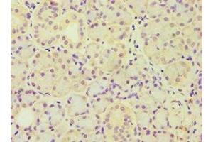 Immunohistochemistry of paraffin-embedded human pancreatic tissue using ABIN7143446 at dilution of 1:100 (ARF3 antibody  (AA 1-181))