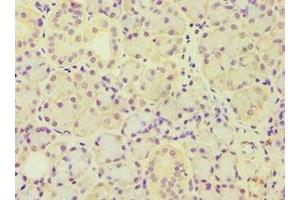 Immunohistochemistry of paraffin-embedded human pancreatic tissue using ABIN7143446 at dilution of 1:100 (ARF3 antibody  (AA 1-181))