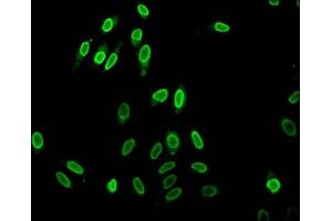 Immunofluorescent analysis of Hela cells (sodium butyrate, 30 mM, 4h) using ABIN7139207 at dilution of 1:100 and Alexa Fluor 488-congugated AffiniPure Goat Anti-Rabbit IgG(H+L)