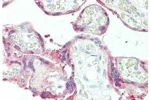 Immunohistochemistry of rabbit anti-Plasminogen Activator 2 antibody (ABIN349627). (SERPINB2 antibody  (Internal Region))