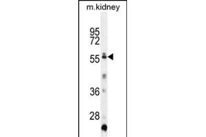 TRIML1 Antibody (C-term) (ABIN655761 and ABIN2845204) western blot analysis in mouse kidney tissue lysates (35 μg/lane).
