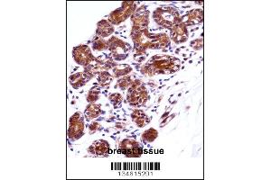 IMPDH1 Antibody immunohistochemistry analysis in formalin fixed and paraffin embedded human breast tissue followed by peroxidase conjugation of the secondary antibody and DAB staining. (IMPDH1 antibody  (N-Term))