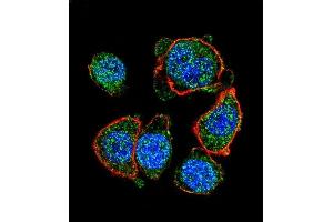 Confocal immunofluorescent analysis of MITF Antibody (N-term) (ABIN655506 and ABIN2845022) with hela cell followed by Alexa Fluor 488-conjugated goat anti-rabbit lgG (green). (MITF antibody  (N-Term))