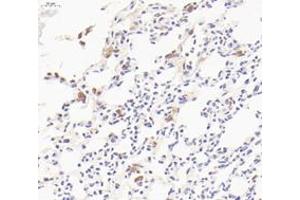 Immunohistochemistry analysis of paraffin-embedded mouse lung with LPS treated for 24h using CD206 (ABIN7074550) at dilution of 1: 800