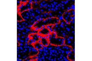 Immunofluorescence (Paraffin-embedded Sections) (IF (p)) image for anti-Linker For Activation of T Cells Family, Member 2 (LAT2) antibody (ABIN7074503)