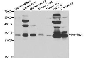 Western blot analysis of extracts of various cell lines, using PHYHD1 antibody. (PHYHD1 antibody)