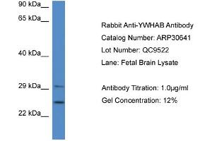 WB Suggested Anti-YWHAB Antibody   Titration: 1. (YWHAB antibody  (Middle Region))