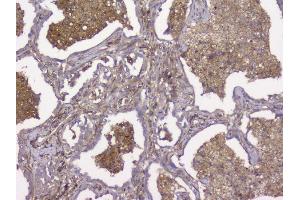 IHC analysis of Beta 2 Microglobulin using anti-Beta 2 Microglobulin antibody (ABIN6719452). (beta-2 Microglobulin antibody  (AA 22-119))