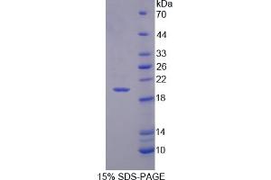 Image no. 1 for CD99 (CD99) (AA 31-185) protein (His tag) (ABIN4988707)