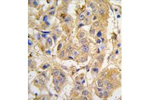 Image no. 1 for anti-Mitochondrial Intermediate Peptidase (MIPEP) (Center) antibody (ABIN356963) (MIPEP antibody  (Center))