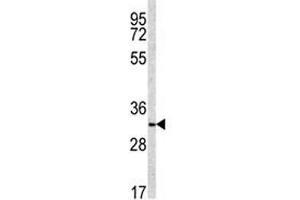 Western blot analysis of NQO1 antibody and NCI-H460 lysate (NQO1 antibody  (AA 118-144))