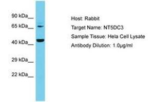 Image no. 1 for anti-5'-Nucleotidase Domain Containing 3 (NT5DC3) (AA 30-79) antibody (ABIN6750613) (NT5DC3 antibody  (AA 30-79))