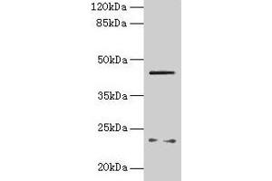 Western blot All lanes: FIBP antibody at 6 μg/mL + MCF-7 whole cell lysate Secondary Goat polyclonal to rabbit IgG at 1/10000 dilution Predicted band size: 42 kDa Observed band size: 42 kDa (FIBP antibody  (AA 2-357))