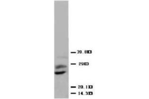 Western blot analysis of human placenta tissue lysis using PLGF antibody (PLGF antibody  (N-Term))