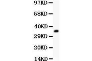 Western Blotting (WB) image for anti-Guanine Nucleotide Binding Protein (G Protein), beta Polypeptide 2-Like 1 (GNB2L1) (AA 2-317) antibody (ABIN3042427) (GNB2L1 antibody  (AA 2-317))
