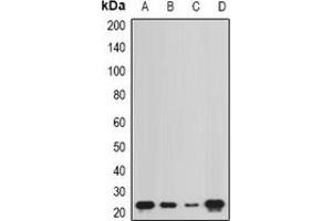 Western blot analysis of NCS1 expression in Hela (A), MCF7 (B), mouse bone marrow (C), rat kidney (D) whole cell lysates. (NCS1 antibody)
