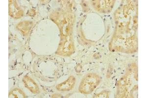 Immunohistochemistry of paraffin-embedded human kidney tissue using ABIN7172386 at dilution of 1:100 (L3HYPDH antibody  (AA 13-312))