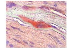 CSF1  CSF1 in human placenta was detected using HRP/AEC red color stain. (M-CSF/CSF1 antibody  (Middle Region))