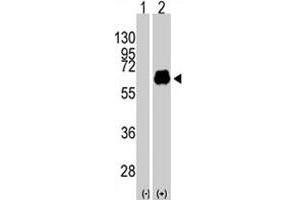 Western blot analysis of MYC (arrow) using MYC polyclonal antibody . (c-MYC antibody  (Thr58))