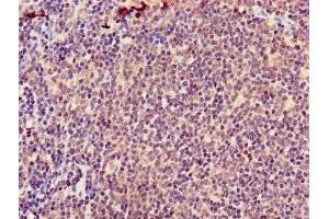 Immunohistochemistry of paraffin-embedded human lymph node tissue using ABIN7145576 at dilution of 1:100 (ATIC antibody  (AA 301-592))