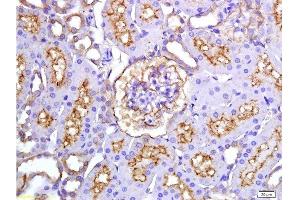 Formalin-fixed and paraffin embedded rat kidney tissue labeled with Anti-ET-1 Polyclonal Antibody, Unconjugated(bsm-0954M) 1:200 at followed by conjugation to the secondary antibody and DAB staining (Endothelin 1 antibody)