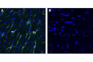 Expression of CD9 in rat fornix. (CD9 antibody  (Extracellular))