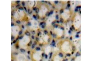 Used in DAB staining on fromalin fixed paraffin-embedded Kidney tissue (Decorin antibody  (AA 45-152))