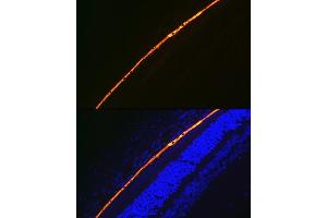 Immunofluorescence (IF) image for anti-Retinal Pigment Epithelium-Specific Protein 65kDa (RPE65) antibody (ABIN7269933)