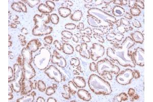 Formalin-fixed, paraffin-embedded human prostate stained with NKX3. (NKX3-1 antibody  (AA 92-224))