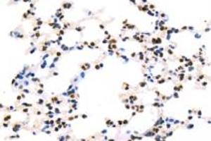 Immunohistochemistry analysis of paraffin-embedded mouse lung using BAAT1 (ABIN7073502) at dilution of 1: 1000 (BAAT1 antibody)