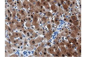 Image no. 4 for anti-Adenylate Kinase 5 (AK5) antibody (ABIN1496535) (Adenylate Kinase 5 antibody)