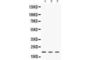 Western blot analysis of Cofilin 2 expression in rat liver extract ( Lane 1), mouse brain extract ( Lane 2) and HELA whole cell lysates ( Lane 3).