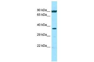 Host: Rabbit  Target Name: NFKBIA  Sample Tissue: Hela Whole Cell lysates  Antibody Dilution: 1. (NFKBIA antibody  (N-Term))