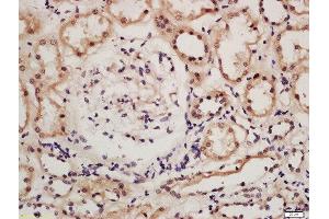 Formalin-fixed and paraffin embedded human kidney tissue labeled with Rabbit Anti-IRF9 Polyclonal Antibody, Unconjugated (ABIN2177064) at 1:200 followed by conjugation to the secondary antibody and DAB staining (IRF9 antibody  (AA 101-200))