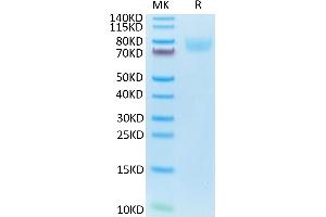 ICAM1 Protein (AA 28-485) (His tag)