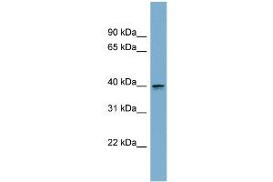 WB Suggested Anti-ASPHD2 Antibody Titration: 0.