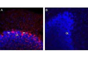 Expression of VGAT in rat cerebellum. (SLC32A1 antibody  (Cytosolic, N-Term))