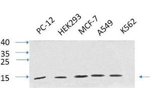 Western Blot analysis of various cells using IL8 Polyclonal Antibody at dilution of 1:1000. (IL-8 antibody)