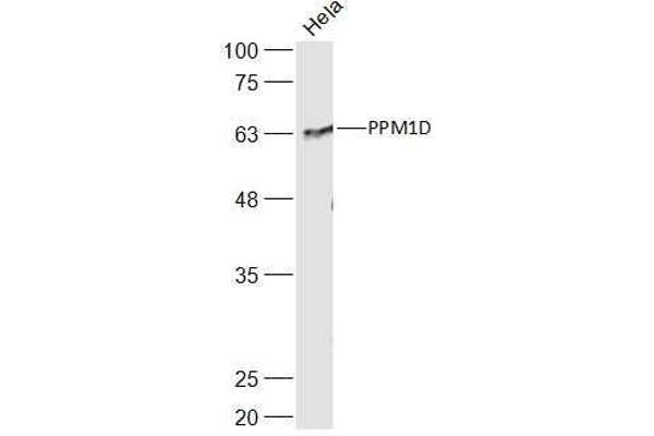 PPM1D Antikörper  (AA 201-300)