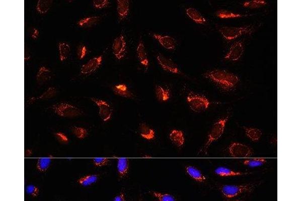 GCSH antibody