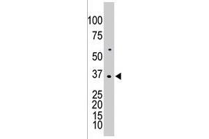 The DGUOK polyclonal antibody  is used in Western blot to detect DGUOK in K-562 cell lysate .