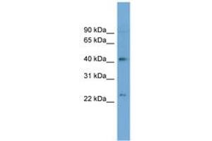 Image no. 1 for anti-ATPase, Aminophospholipid Transporter, Class I, Type 8B, Member 2 (ATP8B2) (AA 35-84) antibody (ABIN6744779) (ATP8B2 antibody  (AA 35-84))