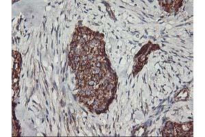 Immunohistochemistry (IHC) image for anti-TNF Receptor-Associated Protein 1 (TRAP1) antibody (ABIN1501499) (TRAP1 antibody)