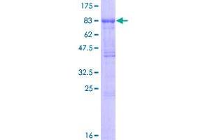Image no. 1 for Transforming Growth Factor, beta Receptor II (70/80kDa) (TGFBR2) (AA 1-567) protein (GST tag) (ABIN1322613) (TGFBR2 Protein (AA 1-567) (GST tag))