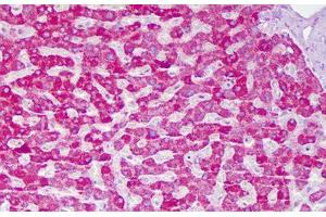 Anti-ACAT1 antibody IHC staining of human liver, hepatocytes. (ACAT1 antibody  (AA 221-270))
